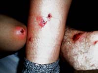 Our collective wounds